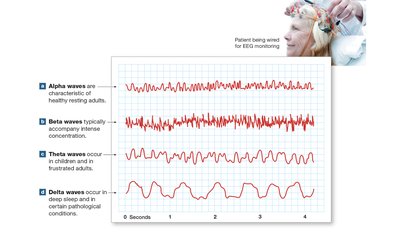 EEG brain wave patterns