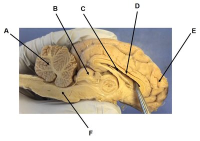 Medial view of a dissected sheep brain with labeled arrows A–F