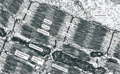 Electron micrograph of sarcomere structure