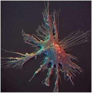 Dendritic cell