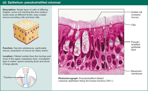 Pseudostratified columnar epithelium.