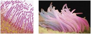 Comparison of transmission and scanning electron micrographs.