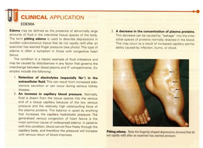 Clinical application: Edema and pitting edema