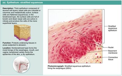 Stratified squamous epithelium.