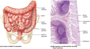 Location of MALT in intestine and micrograph of Peyer's patches