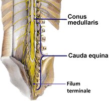 Conus medullaris, cauda equina, and filum terminale