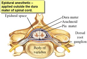 Epidural anesthetic injection site and meninges