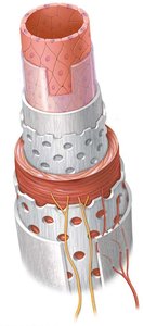 Blood vessel wall layers: intima, media, adventitia
