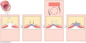 Positive feedback: blood clotting