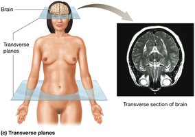 Transverse plane