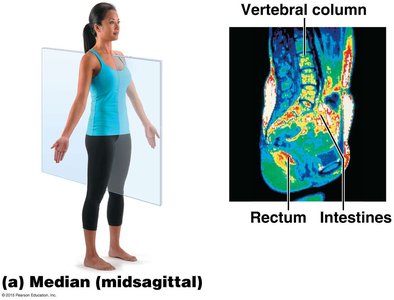 Median (midsagittal) plane