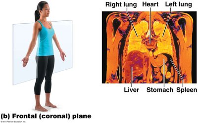 Frontal (coronal) plane