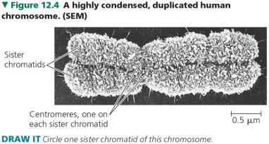 Condensed duplicated human chromosome