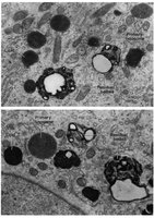 Lysosome electron micrograph