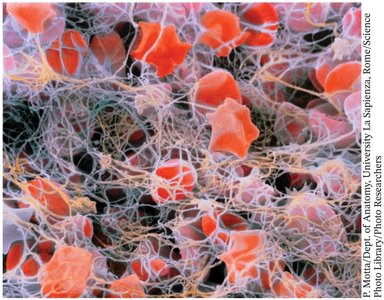 Fibrin mesh trapping red blood cells in a blood clot