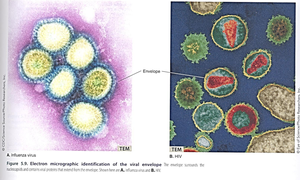 Electron micrograph of viral envelopes