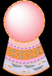 Hyperlipoproteinemia classification table