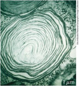Lysosomal storage diseases