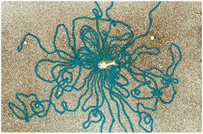 Electron micrograph of DNA released from bacteriophage T2