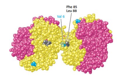 Hemoglobin S structure with Val 6 mutation