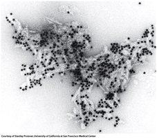 Amyloid fibrils in prion disease