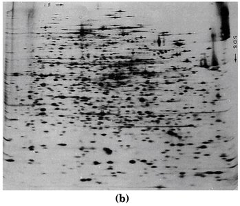 Two-dimensional electrophoresis result