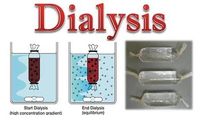 Dialysis setup and principle