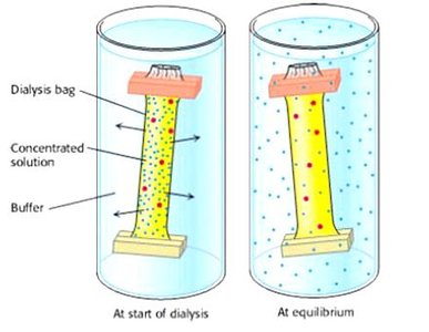 Diagram of dialysis setup