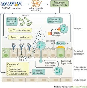 Pathophysiology of AAT deficiency