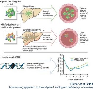 AAT deficiency treatment approaches