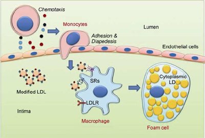 Formation of foam cells from modified LDL uptake by macrophages