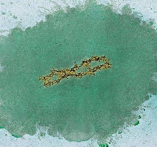 Partially unfolded human chromosome showing DNA loops