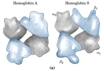 Normal and sickle cell hemoglobin