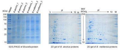 SDS-PAGE and 2D electrophoresis gels