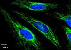 Fluorescence microscopy image of cells