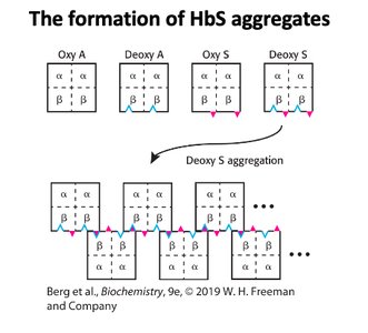 Formation of HbS aggregates in sickle cell disease