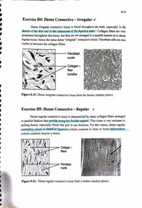 Dense irregular connective tissue