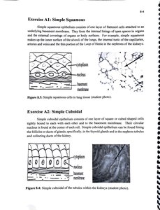 Simple squamous epithelium