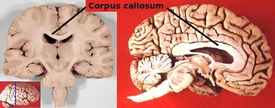 Corpus callosum anatomy