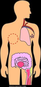 Diagram showing organs commonly affected by cancer