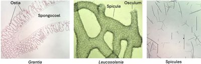 Sponge microanatomy: ostia, spongocoel, osculum, spicules