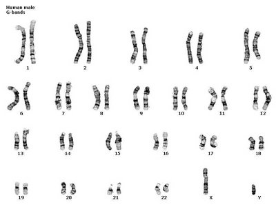 Human karyotype showing autosomes and sex chromosomes