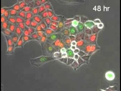 Live cell imaging with FUCCI system