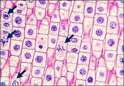 Stained cells with visible mitotic figures