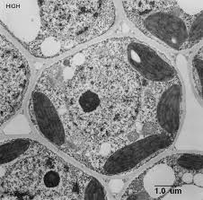 Electron micrograph of a eukaryotic cell