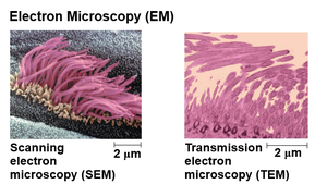 Electron microscopy: SEM and TEM comparison