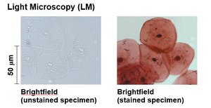 Light microscopy: unstained and stained specimens