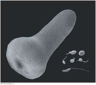 Scanning electron micrograph of an excavate protist