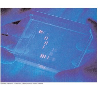 Gel electrophoresis results