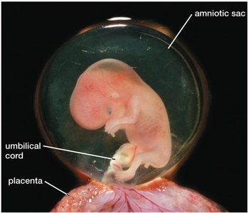 Human fetus in the amniotic sac with placenta and umbilical cord